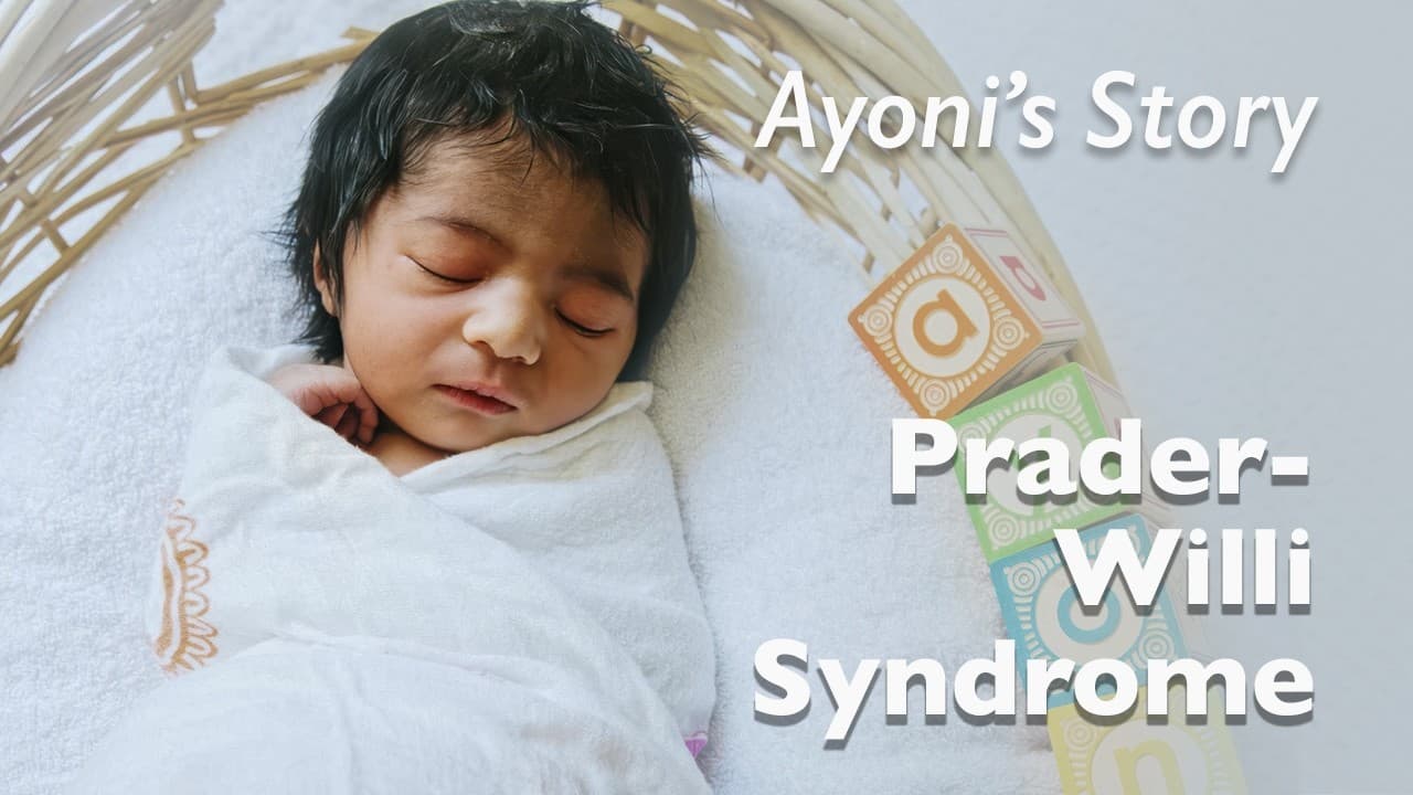 Medical Stories - Prader-Willi Syndrome (PWS): Ayoni's Story